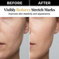 Advanced Firming & Smoothing Body Gel
